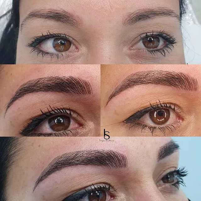 Servicios ojos