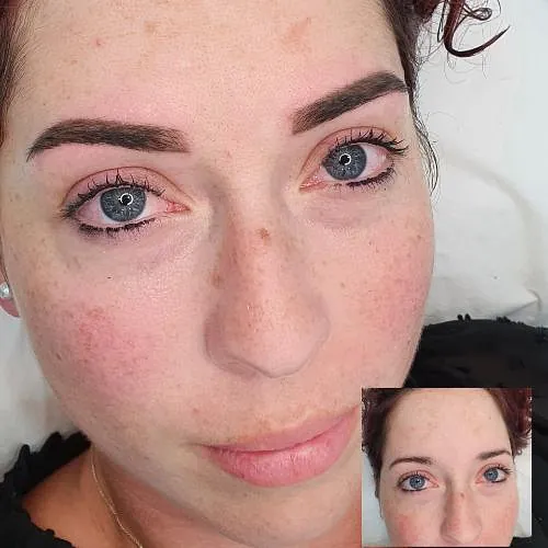 Belleza facial
